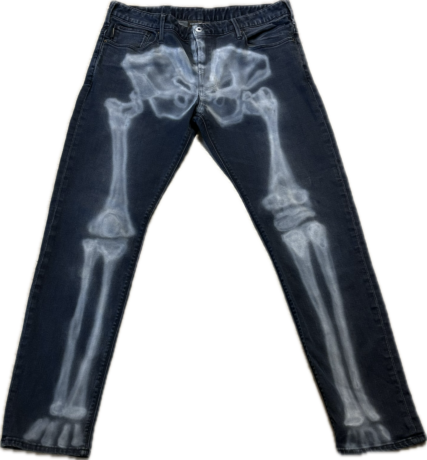 X-RAY