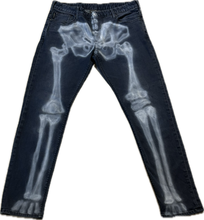 X-RAY