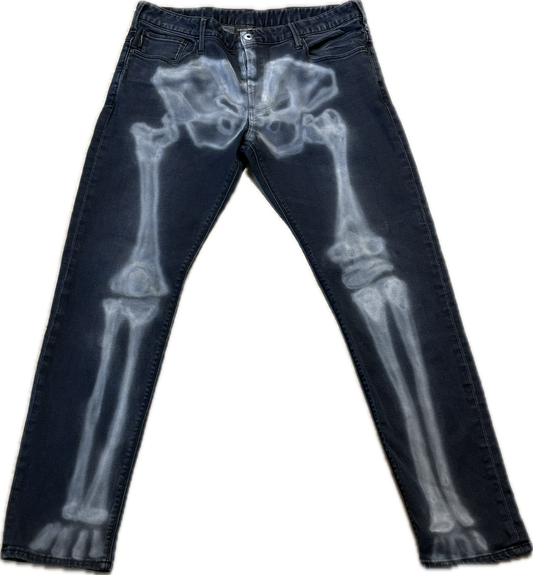 X-RAY